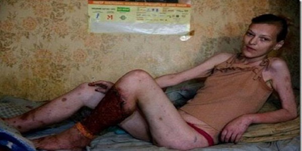 krokodil